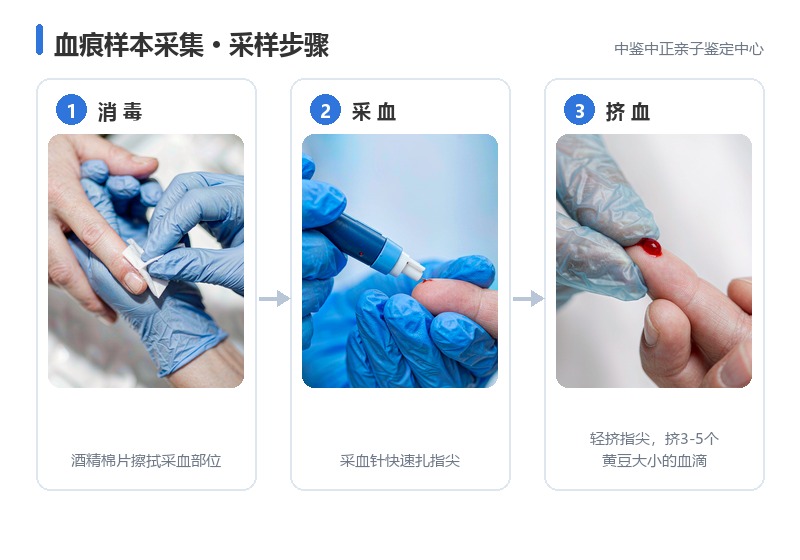 血痕样本采集操作方法 血痕样本采集操作方法